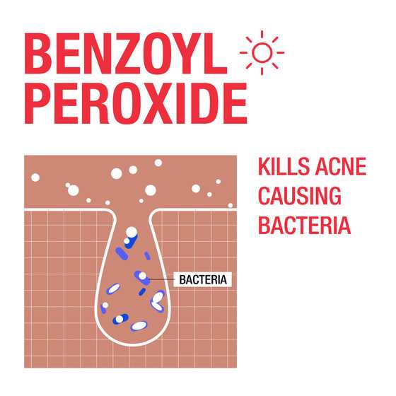 Illustration of how benzoyl peroxide kills acne-causing bacteria