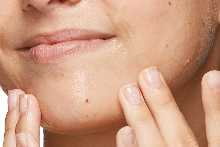 Women with pimples Neutrogena acne wash scrub
